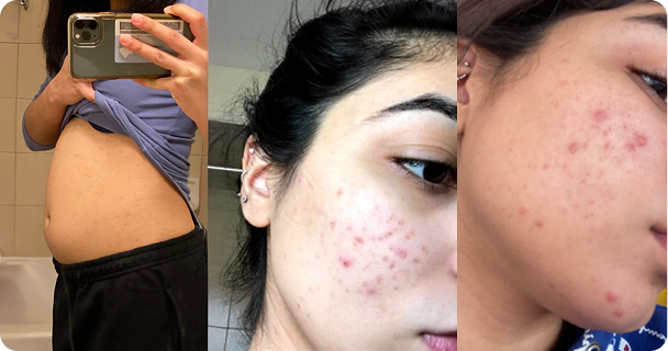 Early Cure Superfoods journey moment